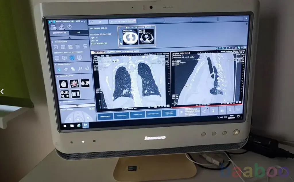 Автоматизированное рабочее место рентгенолога с ру