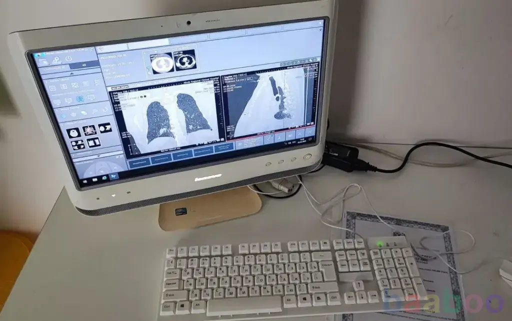 Автоматизированное рабочее место рентгенолога с ру