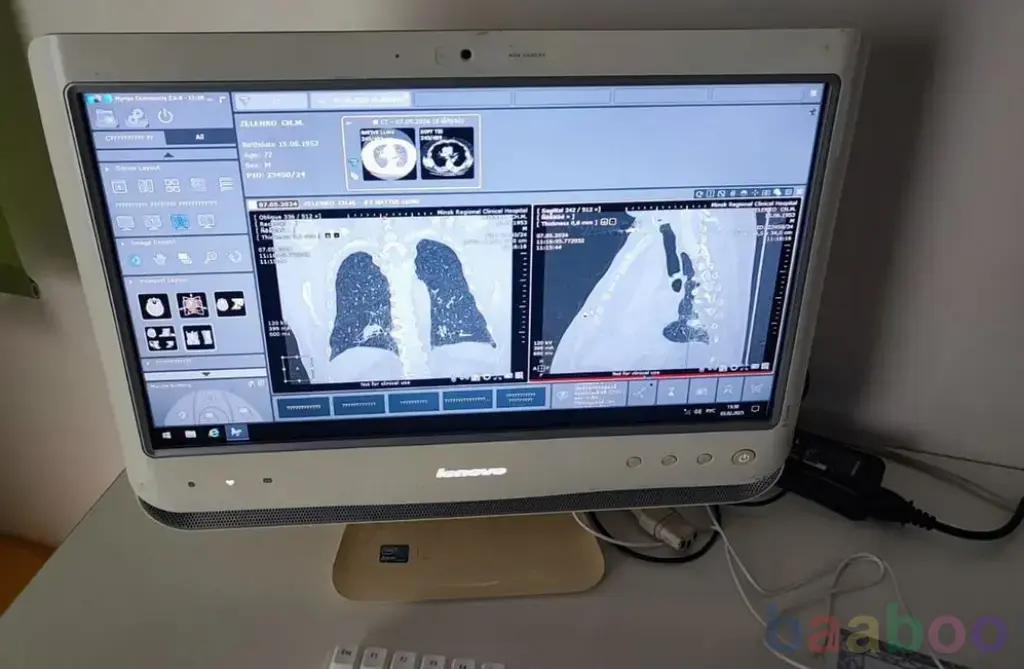 Автоматизированное рабочее место рентгенолога с ру