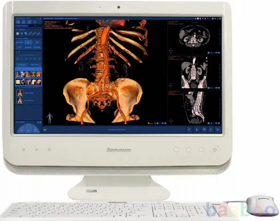 Автоматизированное рабочее место рентгенолога с ру